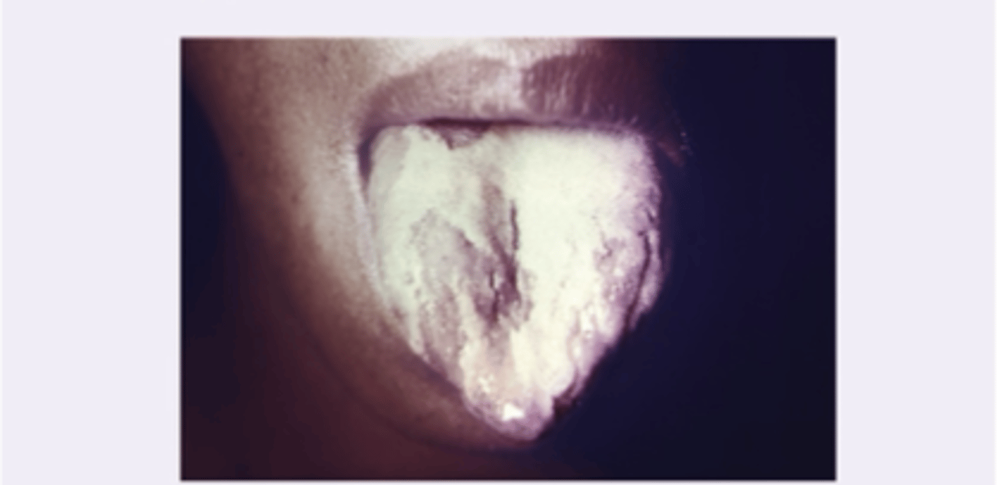 <p>Diagnosis?</p>