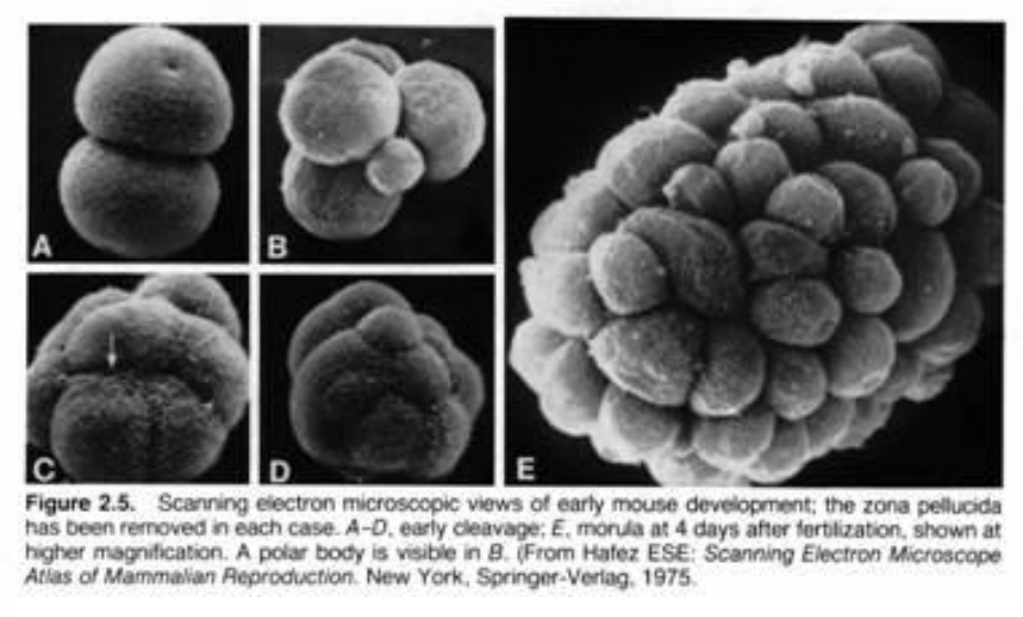 <ul><li><p>solid ball of cells</p></li><li><p>16-64 blastomeres</p></li><li><p>formed near the end of cleavage processes</p></li><li><p>surroounded by the ZP</p></li></ul>