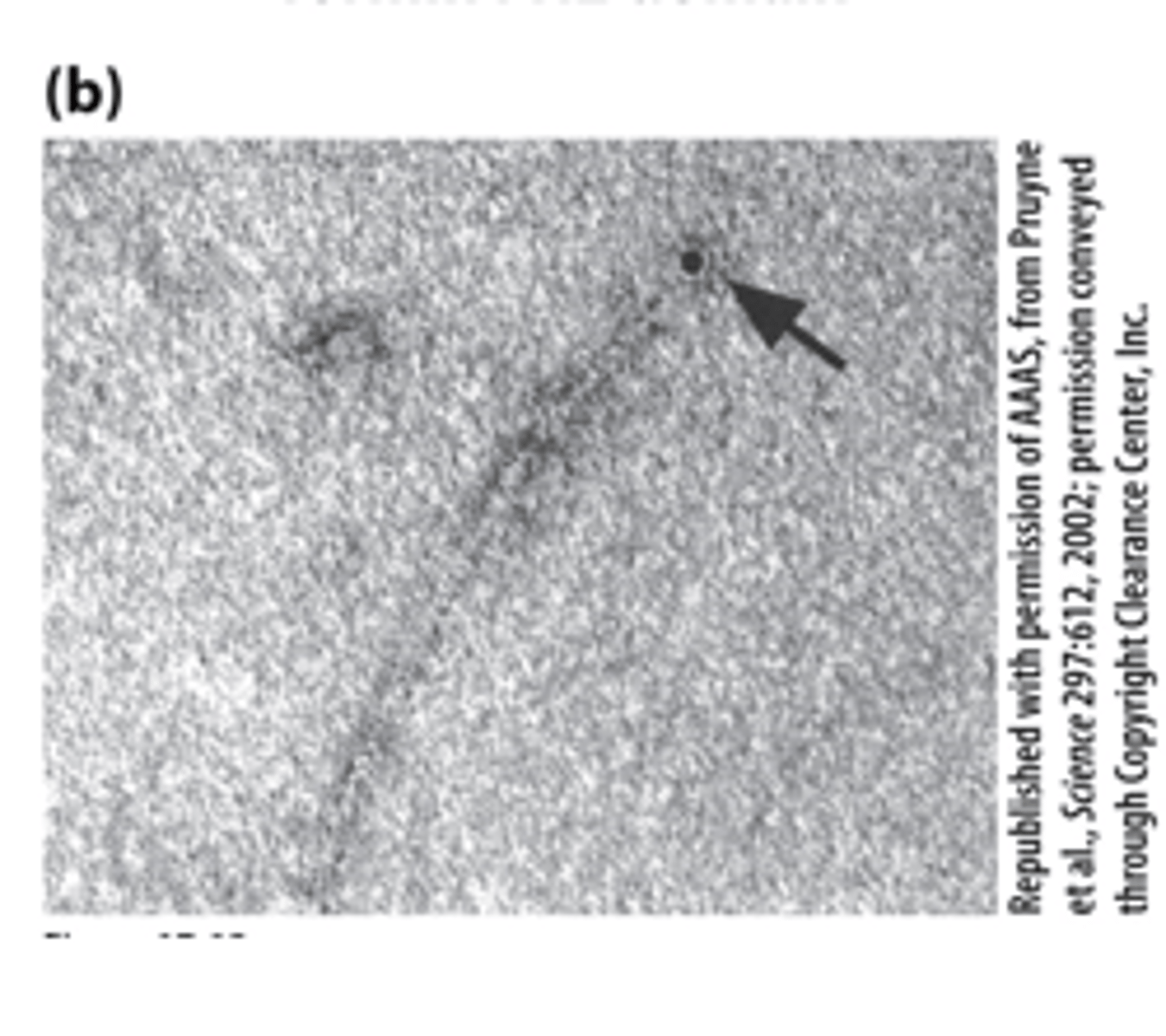 <p>The FH2 domain of a formin labeled with colloidal gold (black dot) nucleated assembly of an actin filament--_______ of a sample negatively stained with uranyl acetate</p>