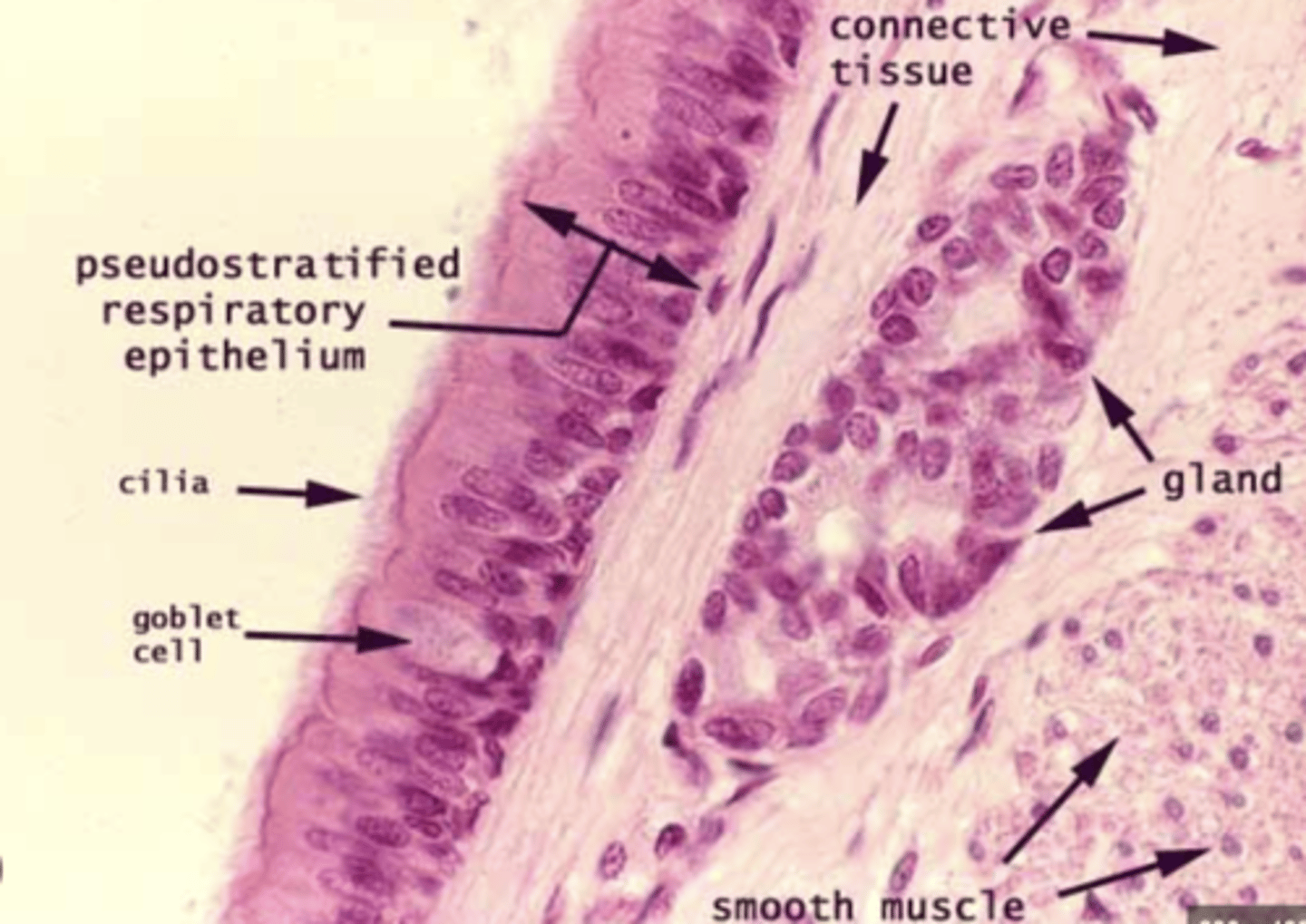 <p>. Stratified squamous epithelium (keratinized and non-keratinized)</p><p>. Olfactory epithelium (in the nasal cavity. Contains serous glands and nerves)</p><p>. Respiratory epithelium (general epithelium found along the respiratory tract)</p><p>EPITHELIUM COVERS THE RESPIRATORY TRACT</p>