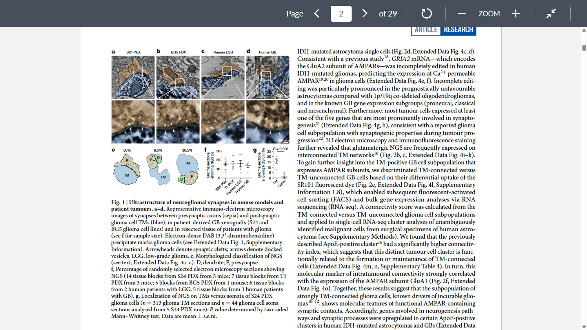 <p>Goal: Show that glioma cells physically form bona fide synapses with neurons</p><p>Methods: Immuno-EM images</p><p>Key takeaway: NGS are consistently formed in incurable human gliomas and mouse models thereof but not in less malignant primary brain tumors, suggesting a specific contribution to the malignant features of astrocytic gliomas, including GB</p>