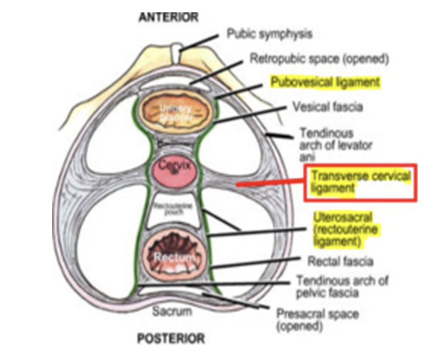 <ul><li><p>Visceral pelvic fascia includes the membranous fascia that directly ensheathes the pelvic organs, forming the adventitial layer of each </p></li><li><p>Membranous parietal &amp; visceral layers become continuous where the organs penetrate the pelvic floor —</p><ul><li><p>Here, the parietal fascia is thickened, forming the tendinous arch of pelvic fascia, a continuous bilateral band running from the pubis to the sacrum along the pelvic floor adjacent to the viscera</p></li></ul></li><li><p>The anteriormost part of this tendinous arch — puboprostatic (males) or pubovesical (females) ligament — connects prostate to pubic in male or fundus (base) of bladder to pubis in female </p></li><li><p>The posteriormost part of this tendinous arch runs as the sacrogenital ligaments from the sacrum around the side of the rectum to attach to the prostate in the male or the vagina in the female</p><ul><li><p>In females, the lateral connection of the visceral fascia of the vagina with the tendinous arch of the pelvic fascia is the paracolpium </p></li><li><p>The paracolpia suspend the vagina between the tendinous arches, assisting it in bearing the weight of the fundus of the bladder</p></li></ul></li></ul>