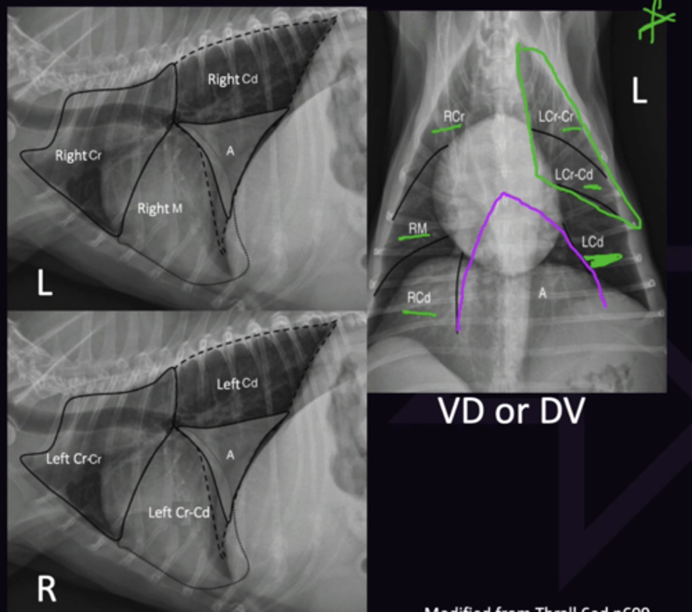 <p>Borders not seen as they are same opacity and share a border so they efface</p><p>1. Cranial, Middle, Caudal, Accessory (On both sides but considered right lobe). Observed on a Left Lateral View</p><p>2. Cranial (Cranial Part), Cranial (Caudal Part), Caudal. Observed on a Right Lateral View</p><p>3. Only Blood Vessels</p>