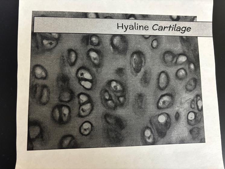 <p>What kind of tissue/cartilage is this?</p>