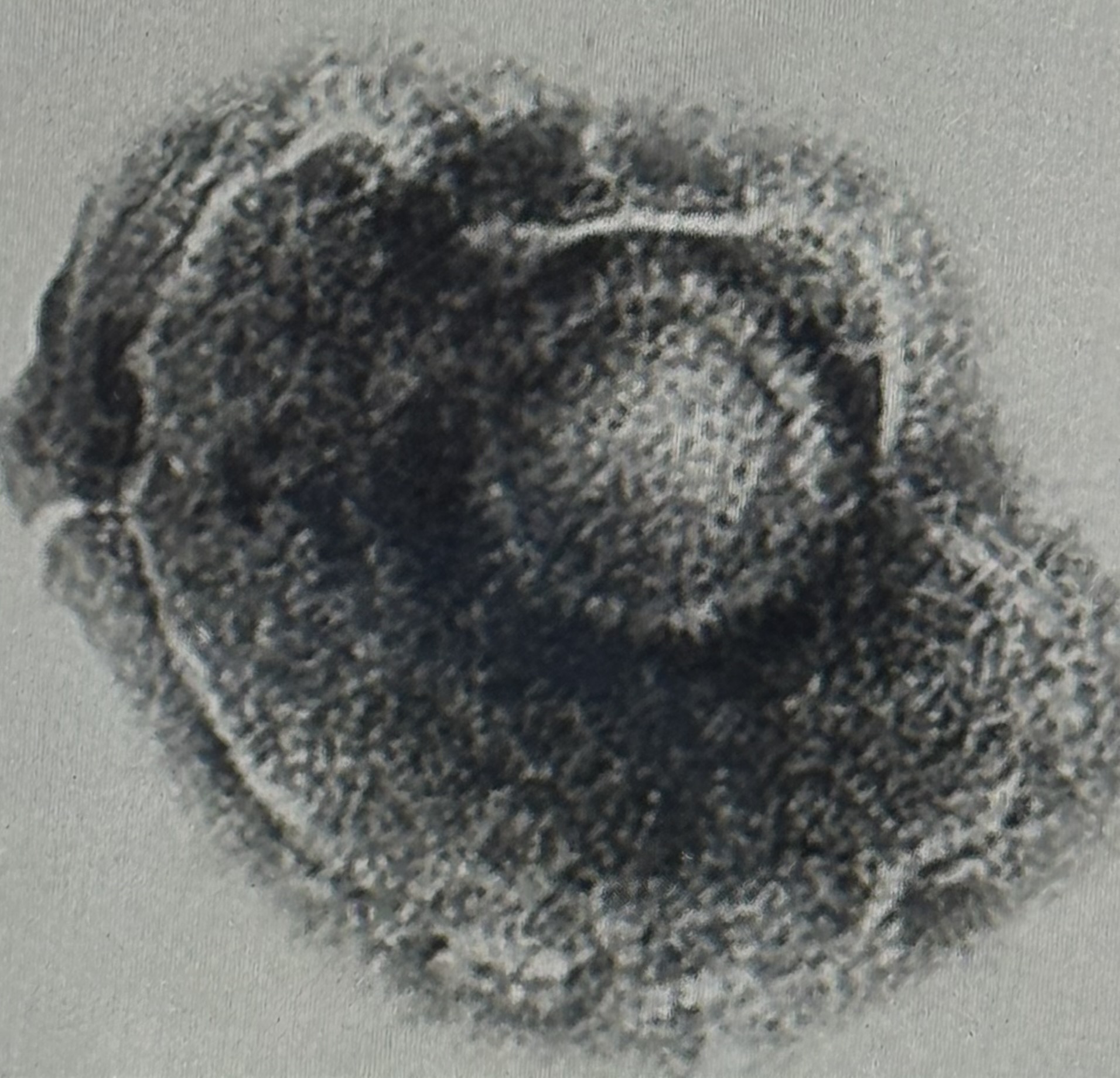 <p>Viren Kurzstrckbriefe Herpesviren</p>