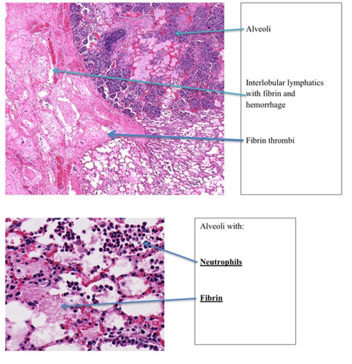 <p>Provide morphological diagnosis</p>