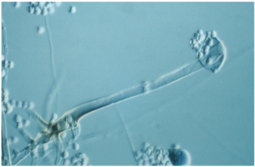 <p>A genus of common saprophytic fungi on plants and in soil.</p>