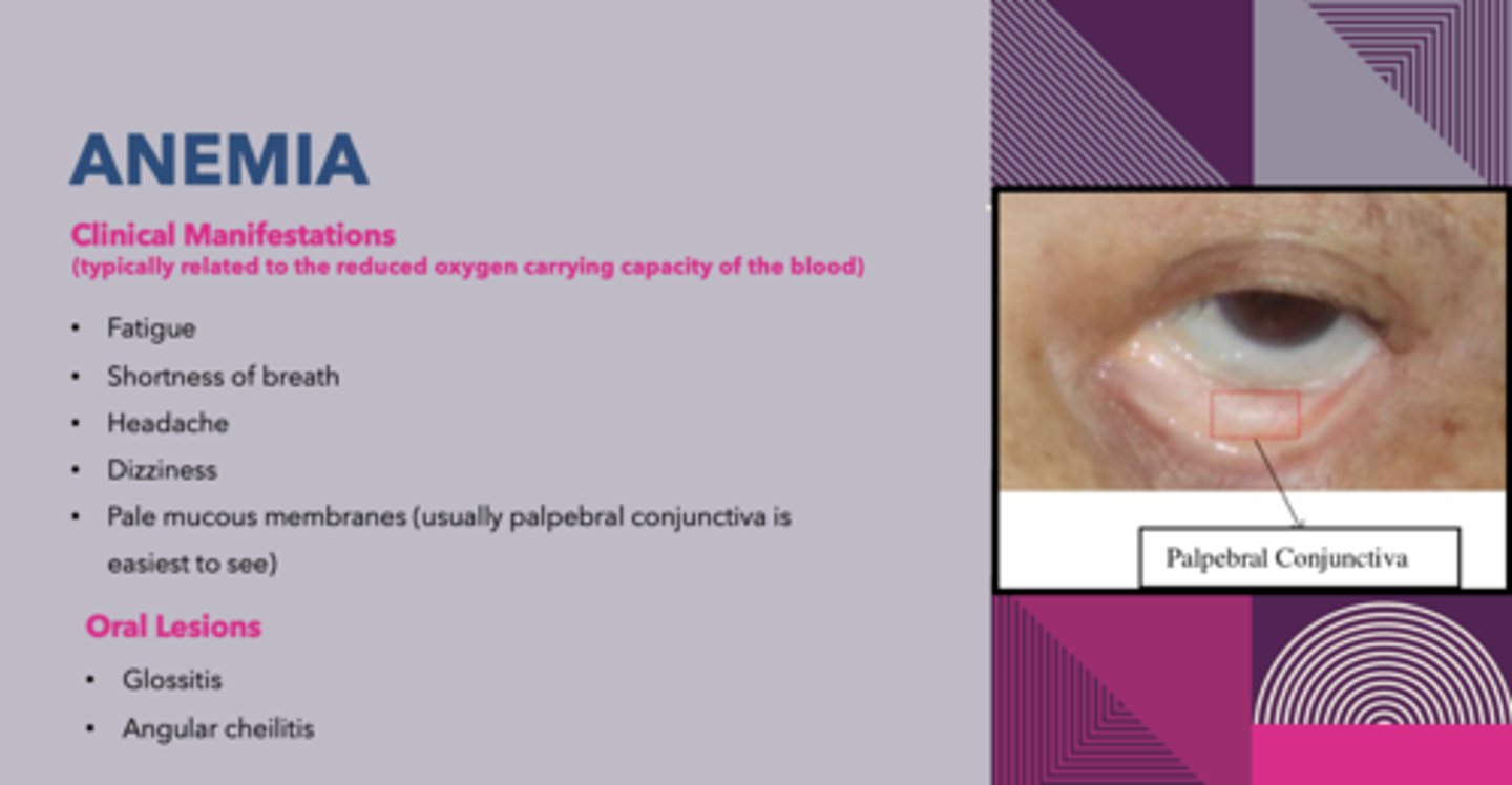 <p>glossitis and cheilosis</p>