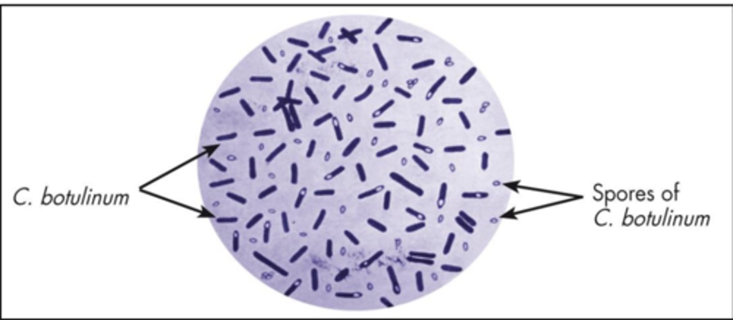 <p>- Toxin is produced by bacteria (Clostridium botulinum)</p><p>- Decreases nicotinic muscle type receptor activation without directly targeting nicotinic receptor</p>