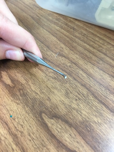 Condense/ pack restoration material (interproximal)