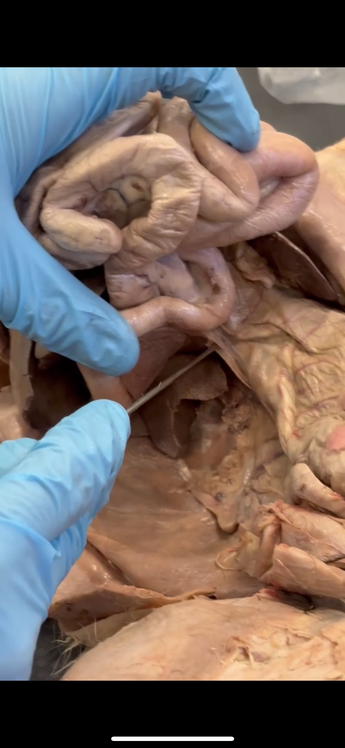 <p>Connects duodenum to descending colon</p>