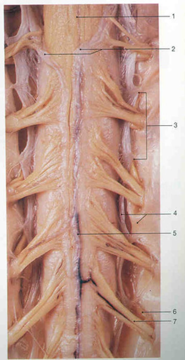 <p>Extensions of pia mater that secure cord to dura mater, anchor the spinal cord laterally and keep it centrally located within the vertebral column<br><br>Triangular-shaped sections of tissue, base is coming from the spinal cord and tip is connecting to the dura mater</p>