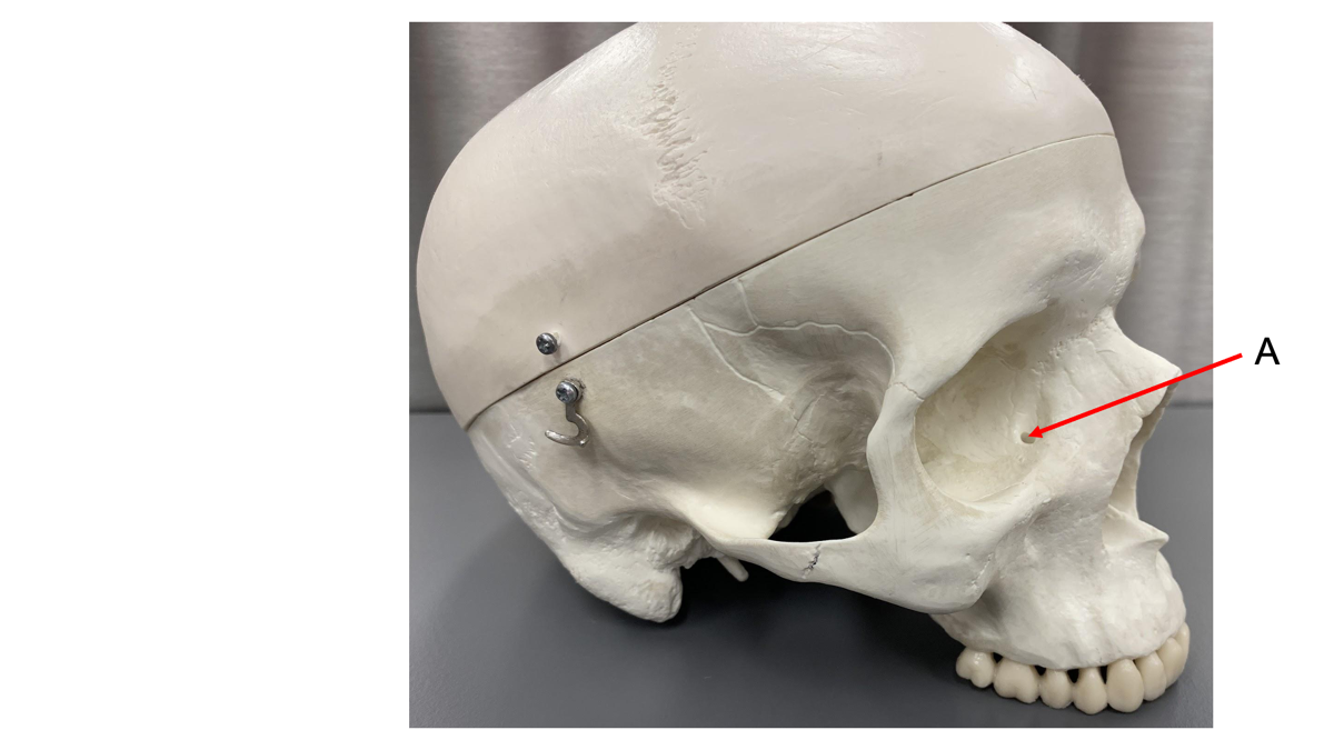 <p>Label A of lacrimal bone</p>