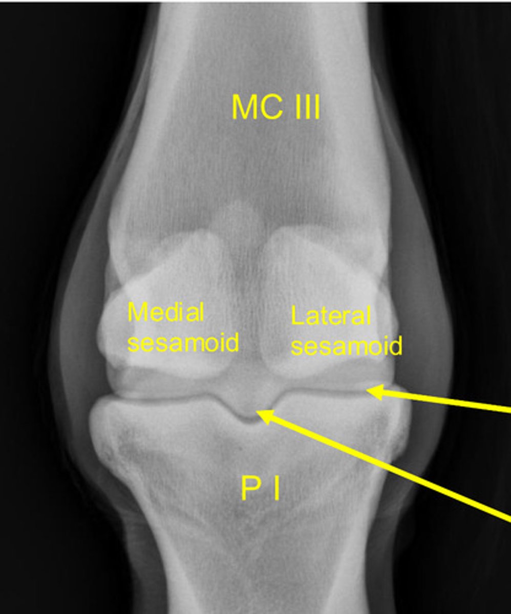 <p>What is the bottom arrow pointing to?</p>