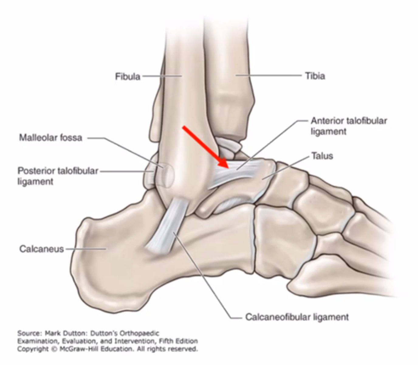 <p>D. Anterior drawer</p><p>A. Kleiger (ER) - for syndesmosis injury</p><p>B - integrity of CFL and ATFL</p><p>C - syndesmosis (high ankle sprain)</p>
