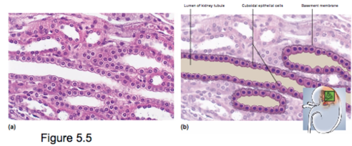 <p>- single layer of square or round cells</p><p>- active transport (absorption or secretion) requires space for organelles inside cell</p><p>- limited protectoin</p>