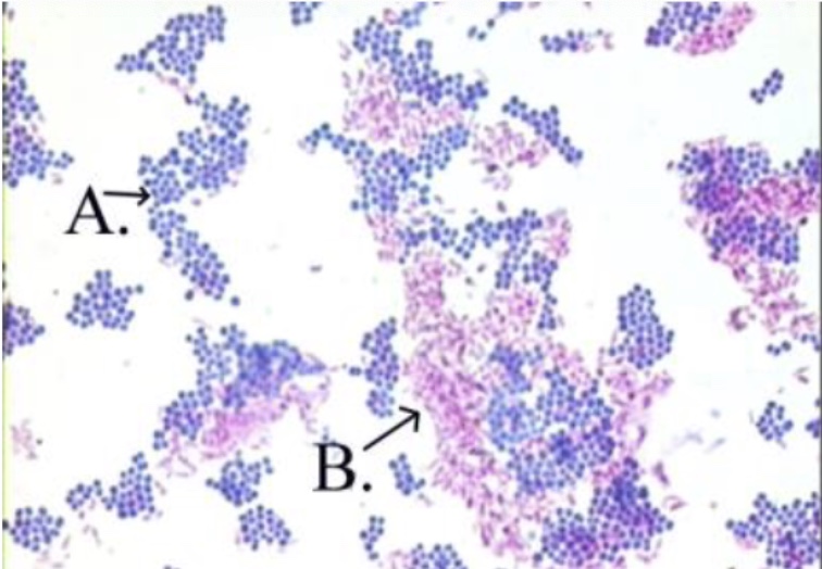 <p>What type of stain is this</p>