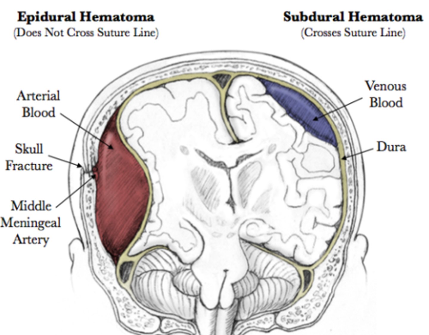 <p>surgical removal</p>