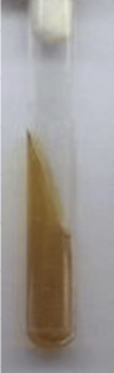 <p>which genus of family Enterobacteriaceae produces this result in a TSI test?</p>