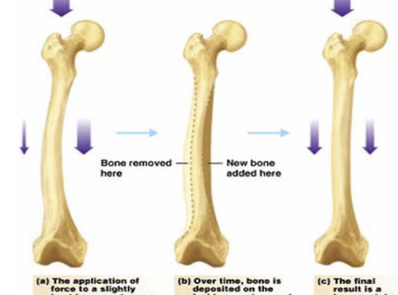 <p>Response of bone to stress</p>