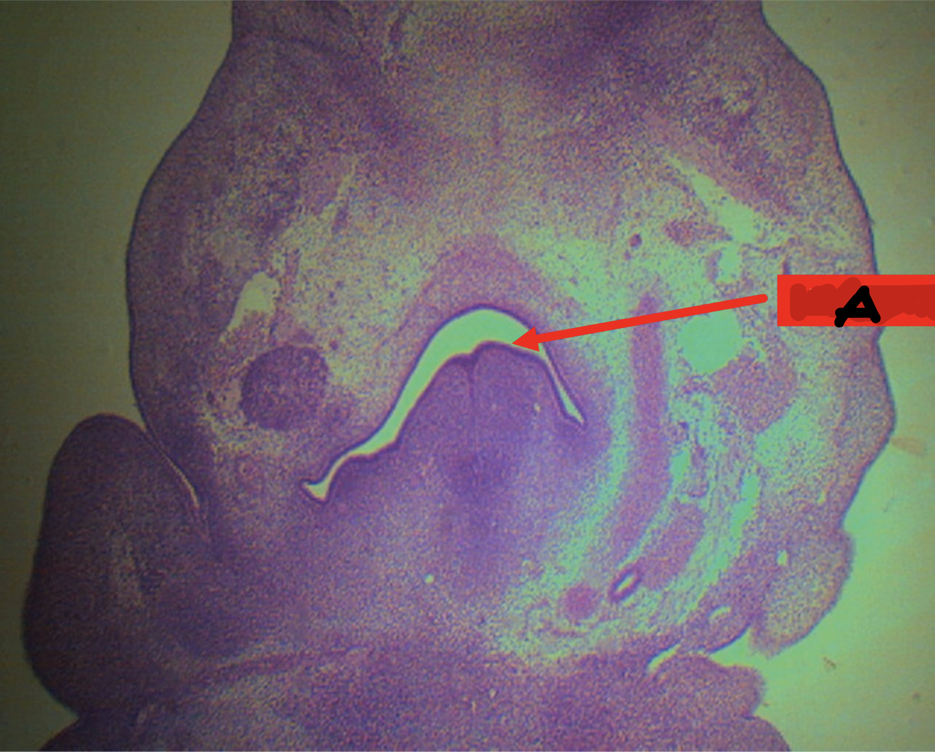 <p>Identify the structure</p>