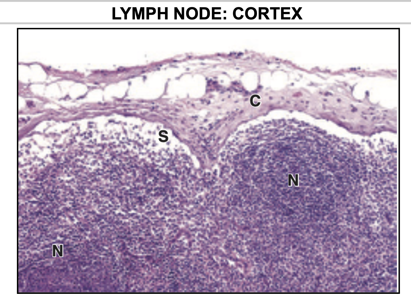 <p>Subcapsular Sinus!</p>