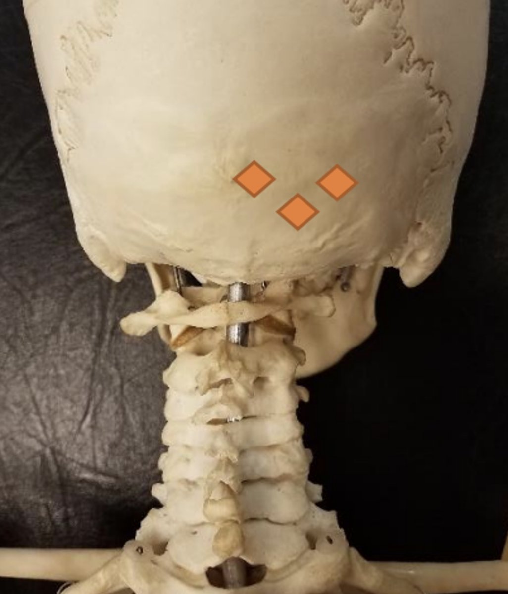 <p>inferior to nuchal line (slightly inferior and medial to PC 1 lateral occiput)</p>