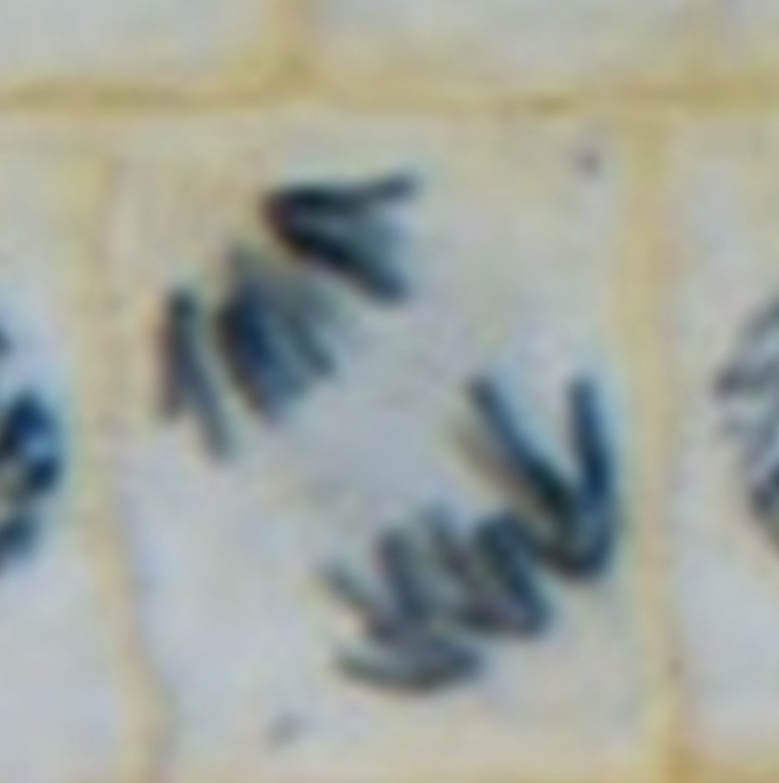 <p>What is the image?</p>