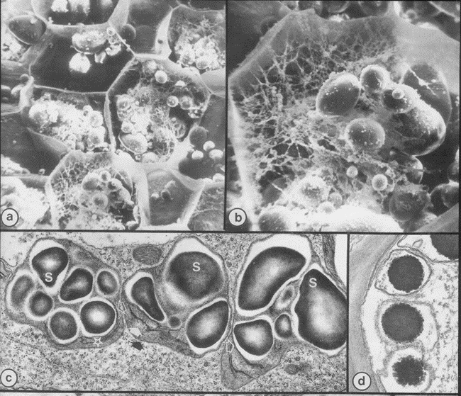 Starch grains in electron micrographs of potato