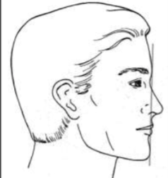 <p>what is this facial profile </p>