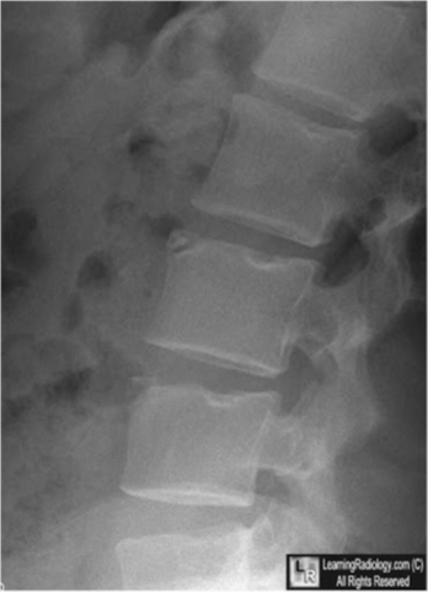 <p>Can you adjust this patient?</p>