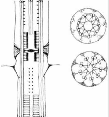 <p>stellate pattern</p>