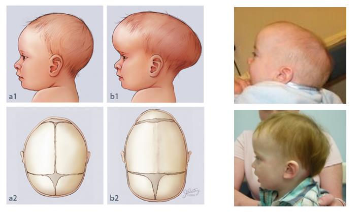 <p>What is this condition called and what causes it?</p>