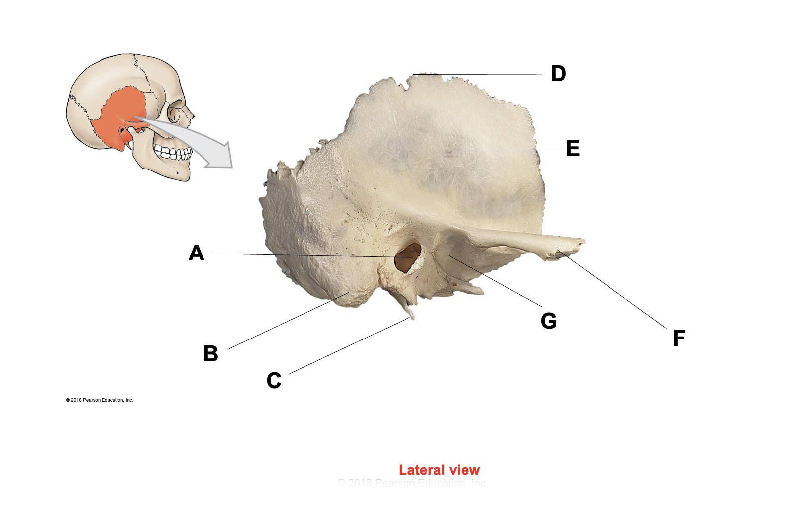 <p>What is letter A</p>
