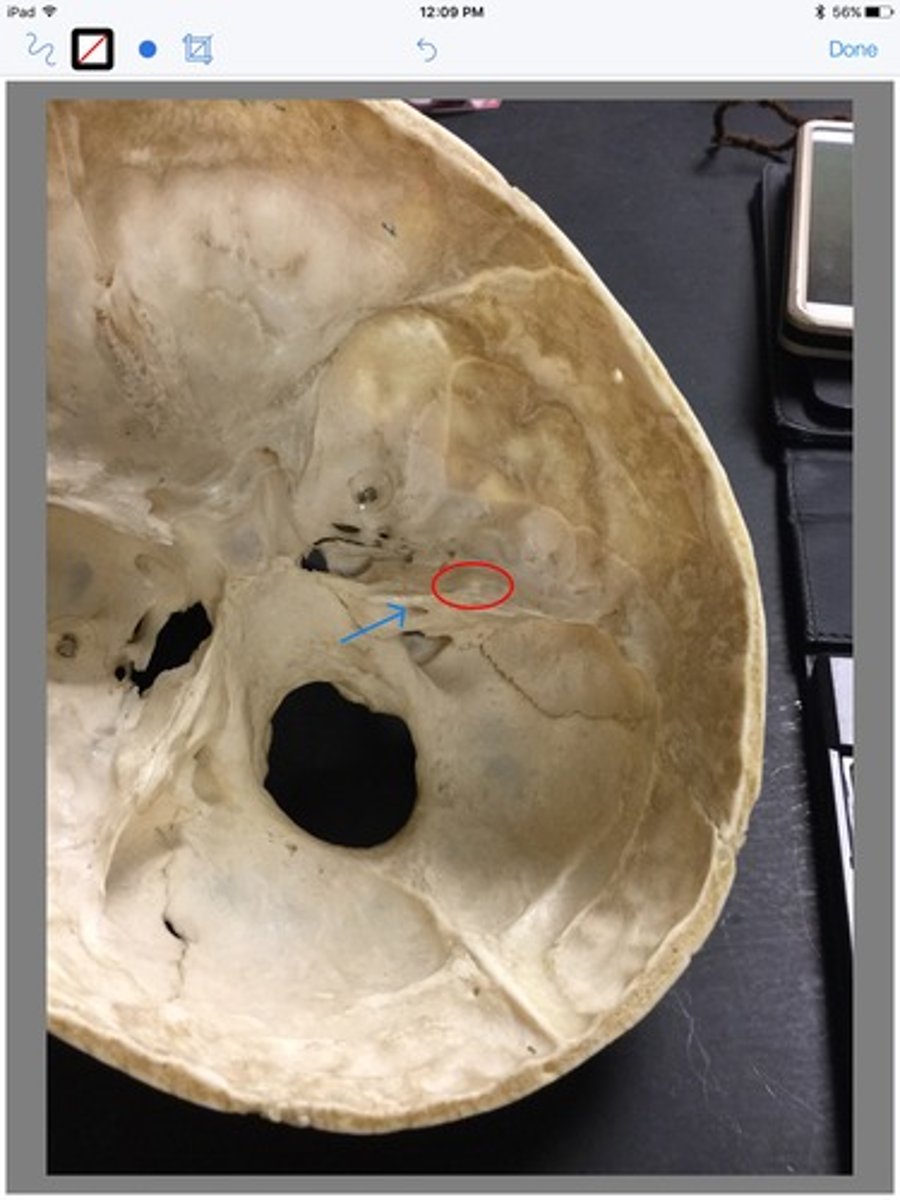 <p>roof of the middle ear (roof of tympanic cavity)</p><p>-thin, smooth area</p>