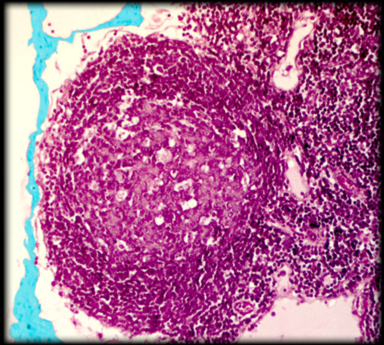 <p>Lymph node</p>