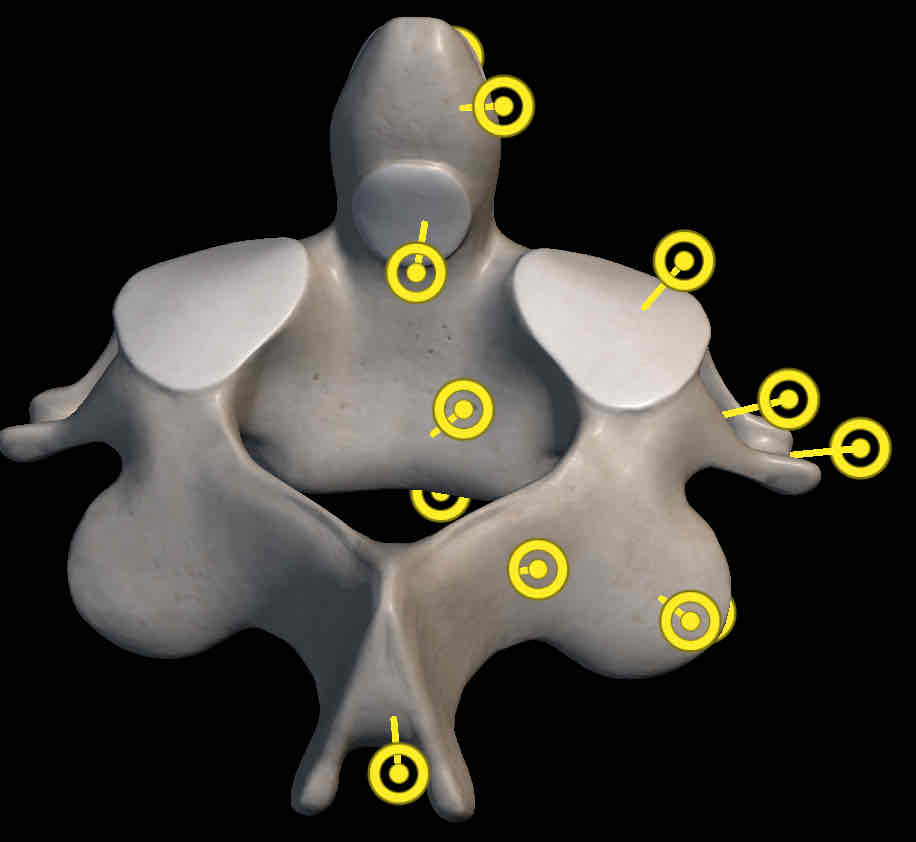 <p>Name this vertebrae</p>