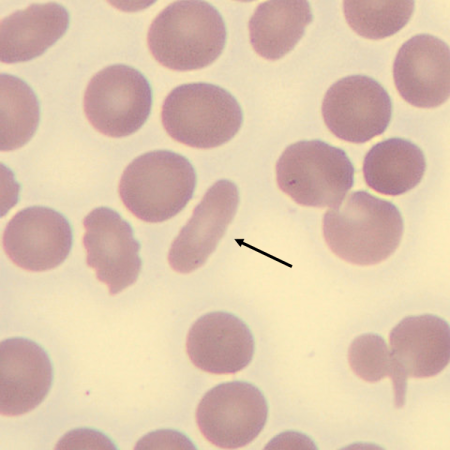 <p>What is the shape of this erythrocyte?</p>