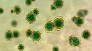 <p>Yes, blastomyces is dimorphic.</p>