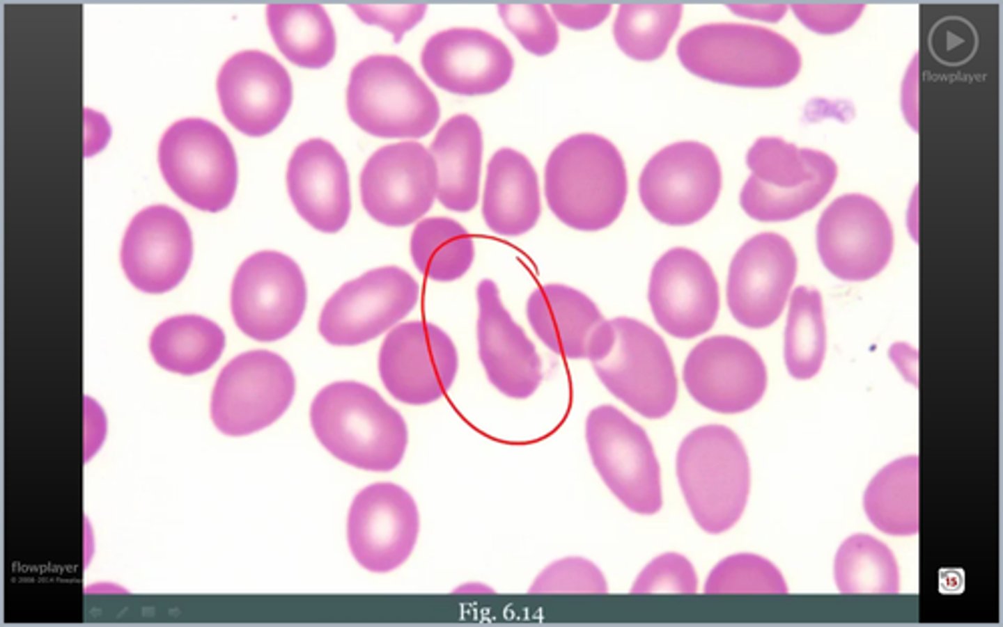 <p>weird RBC</p>