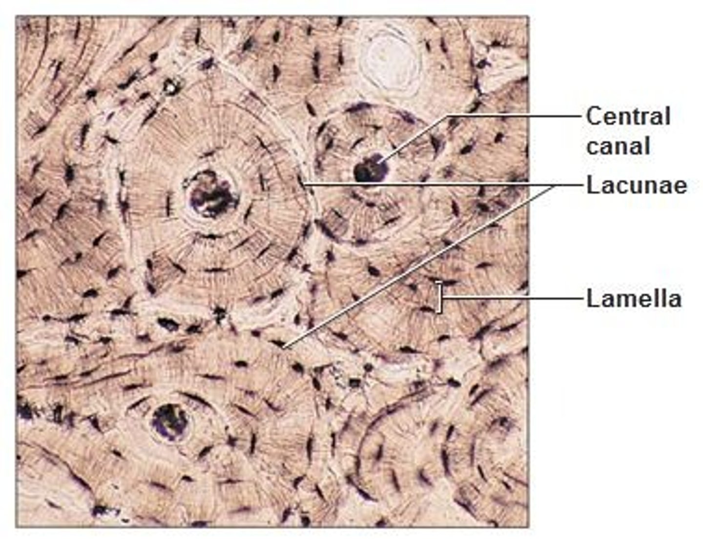<p>osseous tissue with a matrix hardened by calcium phosphate.</p>