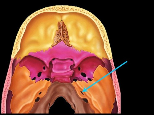 <p>Opening on posterior aspect of temporal bone allowing passage of cranial nerves VII and VIII</p>