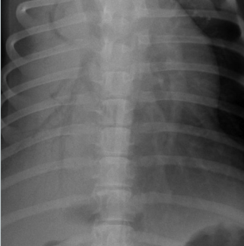 <p>What lung pattern? How do you know? </p>