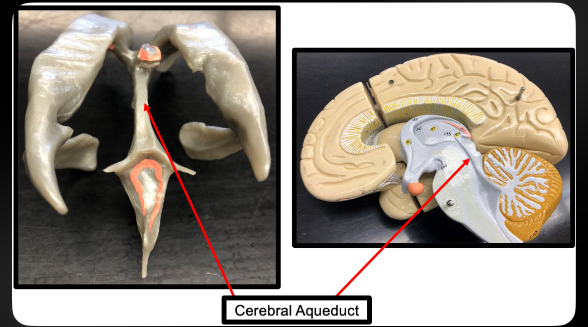 <p>Cerebral Aqueduct</p>