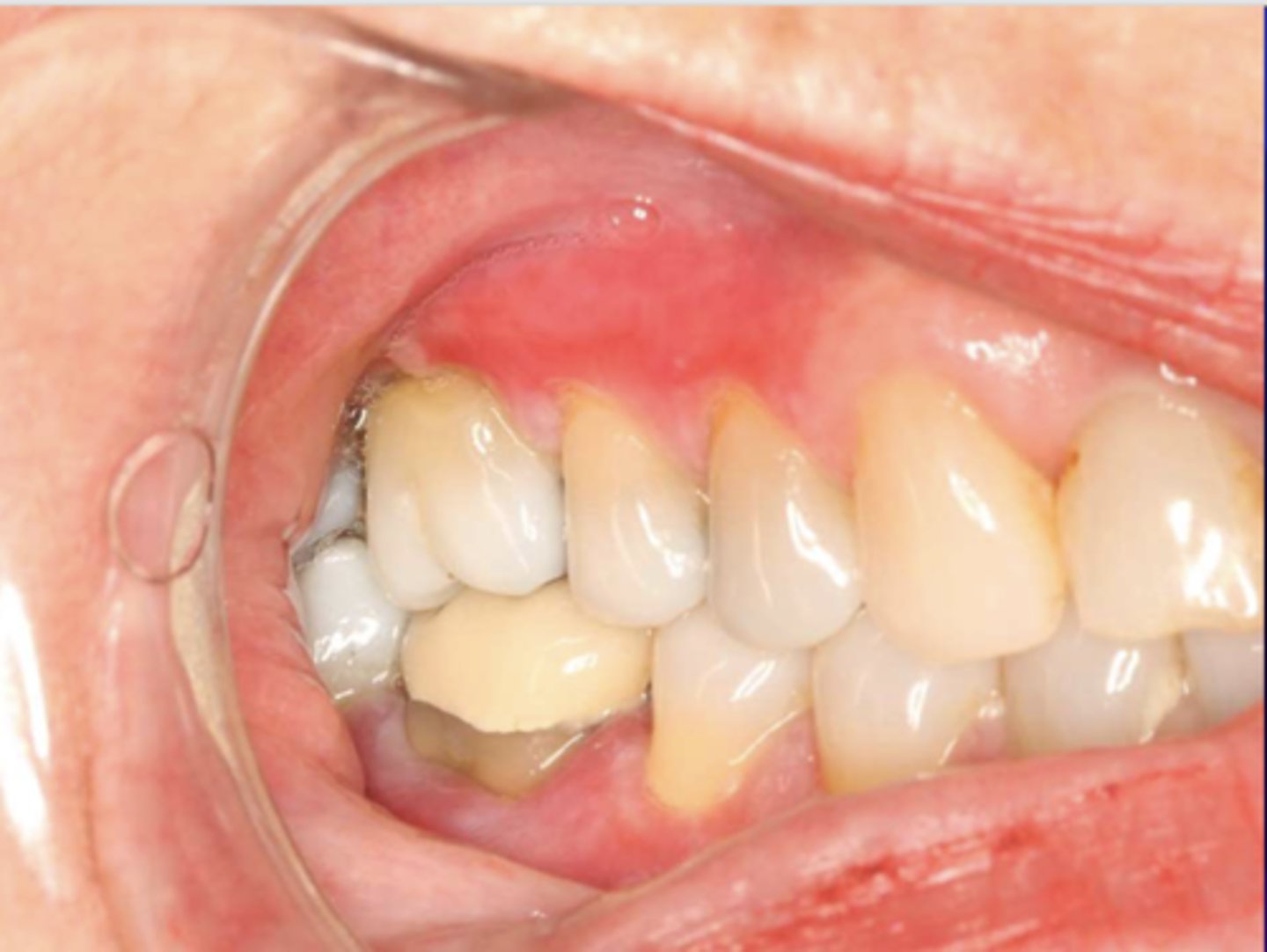 <p>What condition?</p>