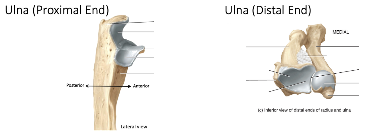 <p>Identify the bone features of the ulna&nbsp;</p>