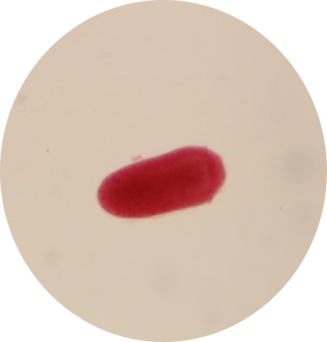 <p>Ciliated Planula Larva</p><p>(free-swimming larvae)</p>