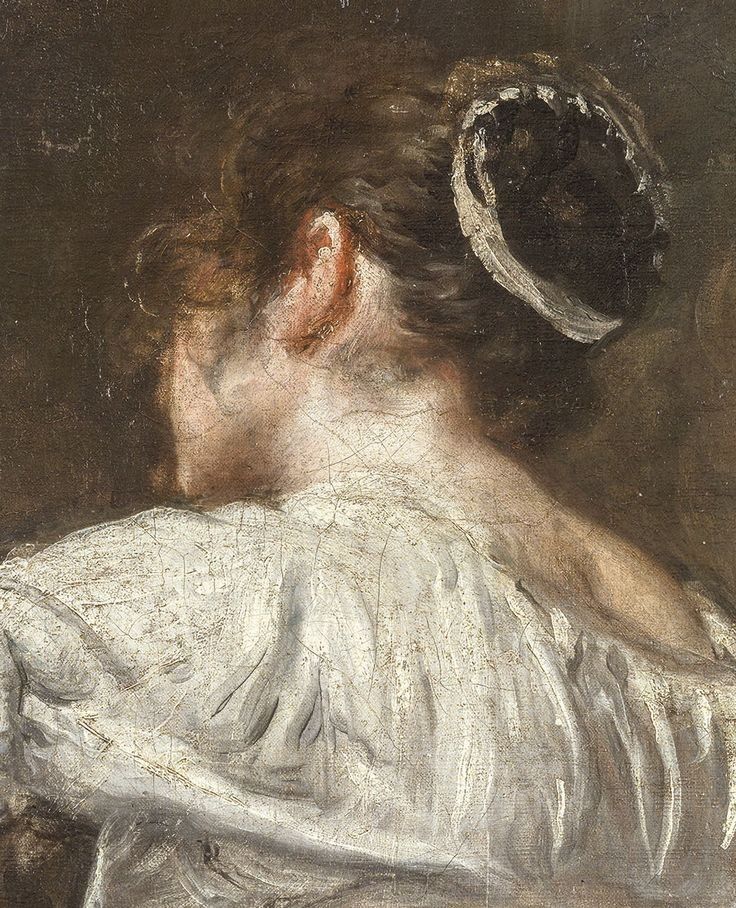 <p>DECOMP- 3) Marbling of Skin</p>