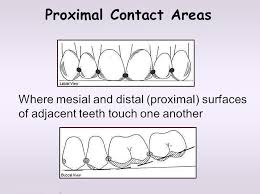 <p>Proximal contact areas</p>