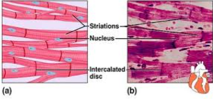 <p><span>1. BLANK muscle tissue is<strong> found ONLY in the HEART</strong> and<strong> consists of branching fibers</strong> that are<strong>&nbsp;connected to each other with intercalated disks.</strong></span></p><p style="text-align: justify"><span>2. This<strong> involuntary muscle </strong>has a <strong>single nucleus in each cell but appears striated.</strong></span></p>